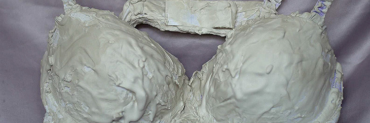 Győrfi Laura - Az endometriózis